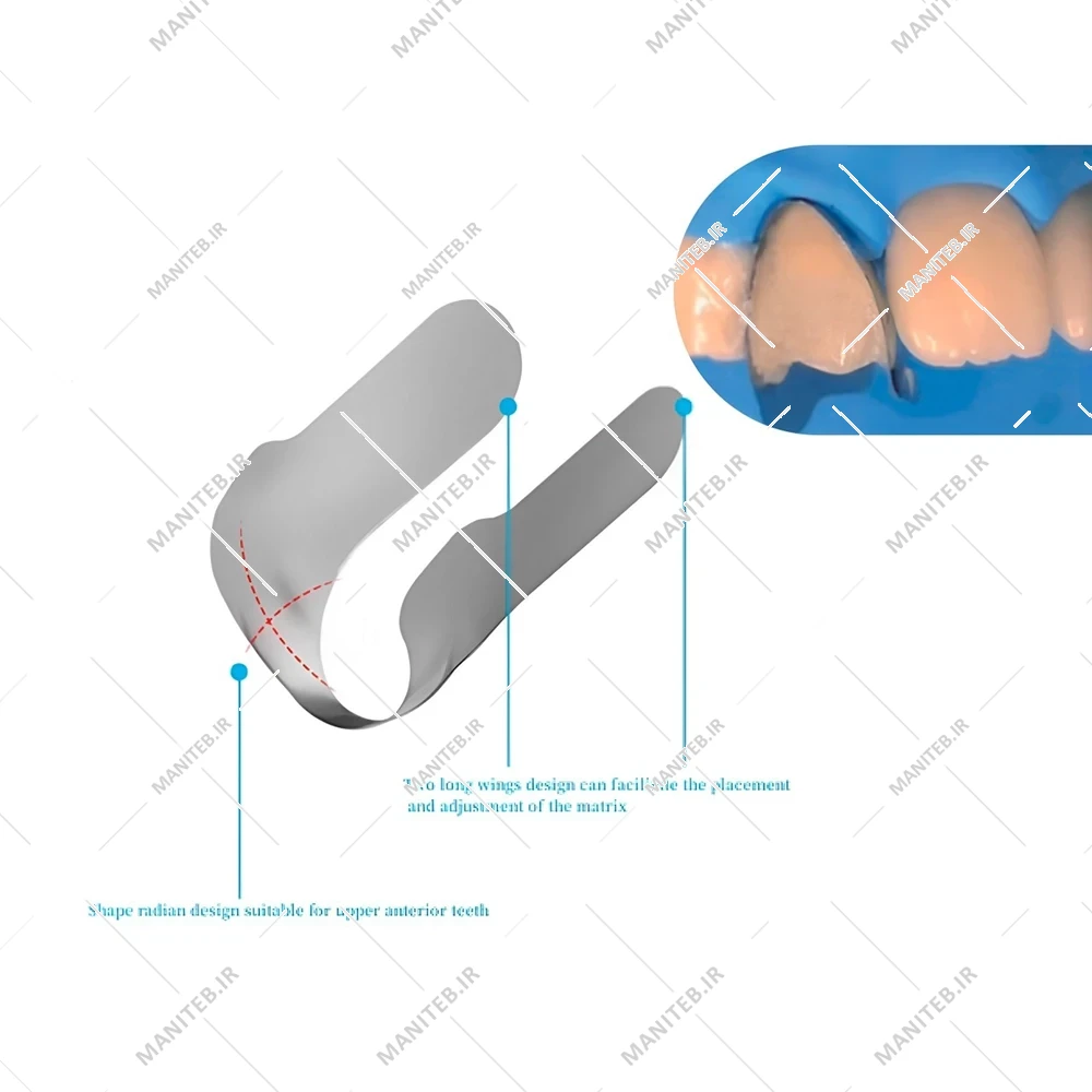 نوار ماتریس ونیر Zt Dental